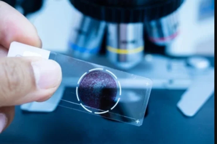 Clinical Pathology------11
