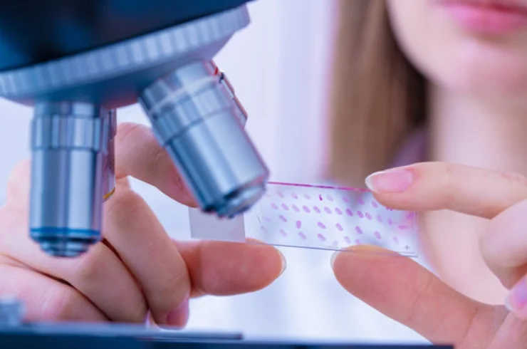 Histopathology------0