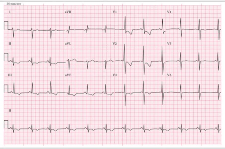 Online ECG with Reports------11